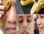 Casca de Banana Para Acne 1