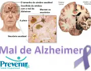 Mal de Alzheimer 2
