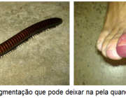 Piolhos-de-Cobra em Casa 3