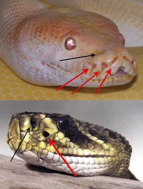 Fosseta Lacrimal 