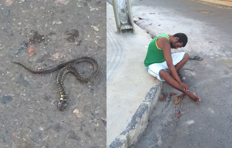 Homem Picado por Cobra Jararacuçu
