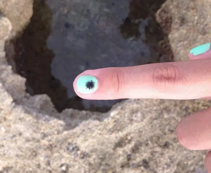 Filhote de Ouriço do Mar Paracentrotus, no Dedo de Uma Mulher