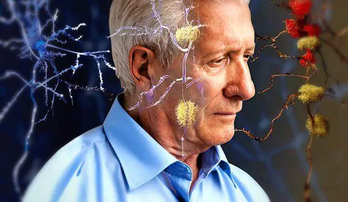 Senhor Com Alzheimer