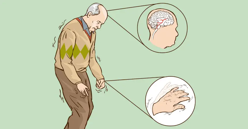 Ilustração de um Homem Com Parkinson