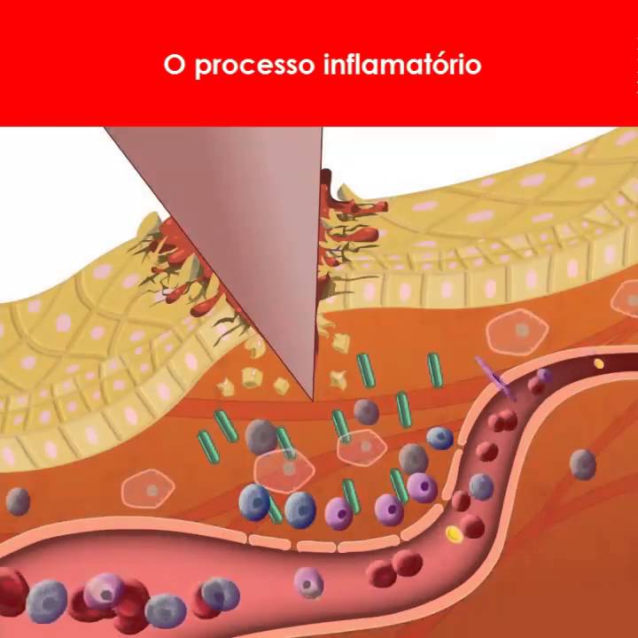 Processos Inflamatórios