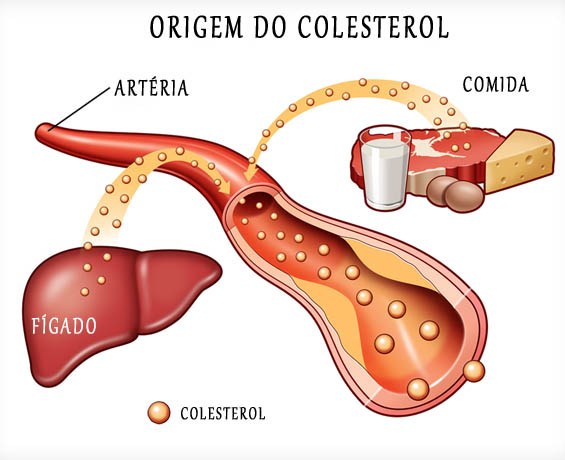 Mal Colesterol