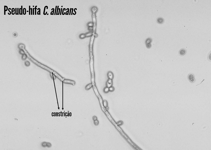 Pseudo-Hifas