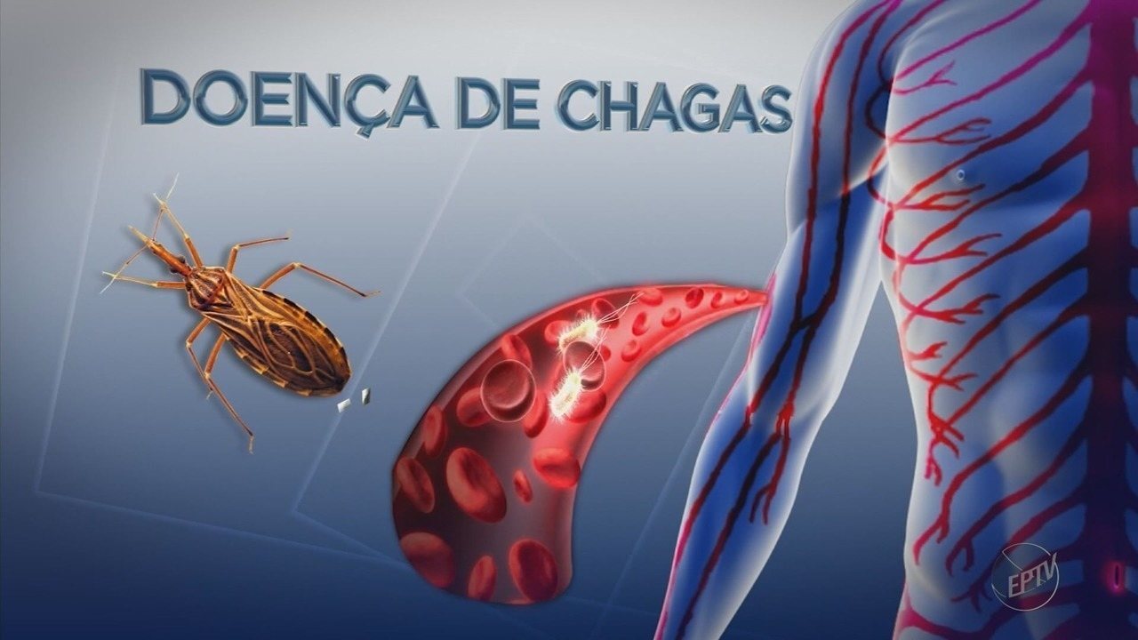 Doença de Chagas