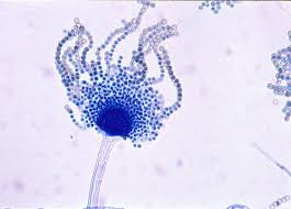 Aspergillus Flavus