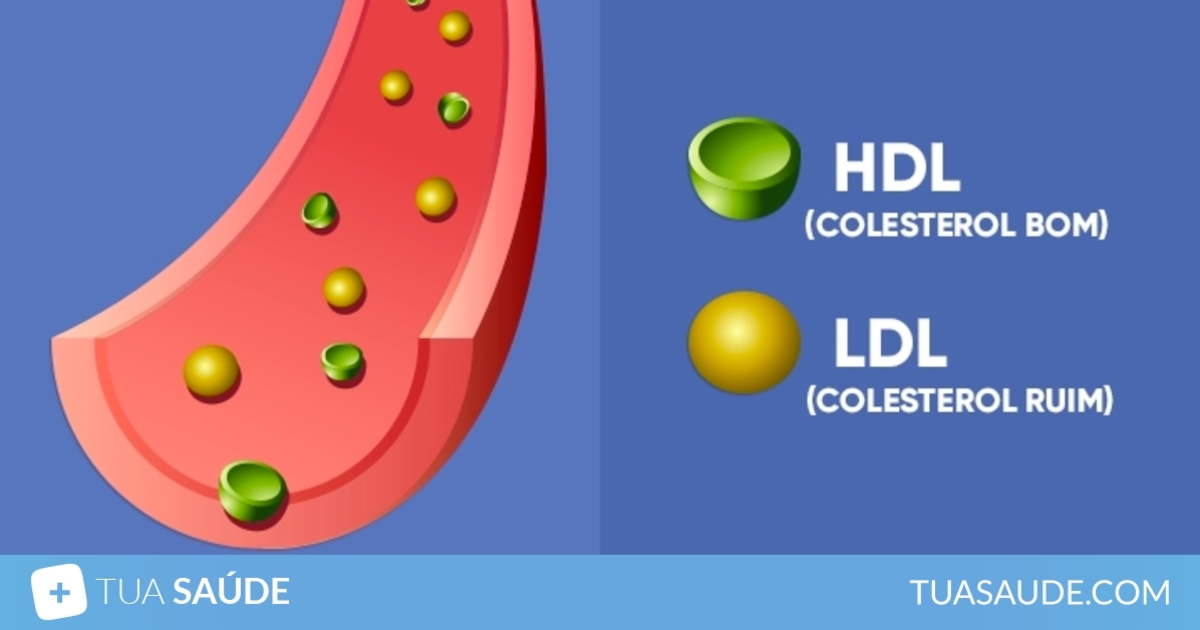 Colesterol 