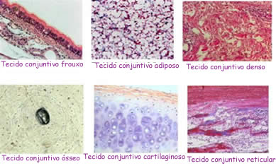 Fibras do Tecido Conjuntivo