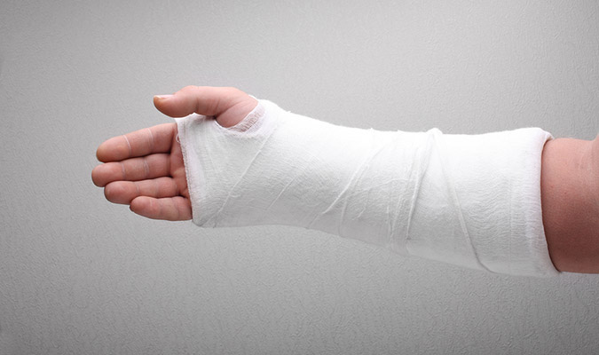 Qual é a Função do Gesso? Pra Que Ele Serve?