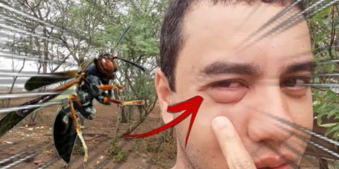 Como Curar a Picada de Marimbondo? O Que Fazer? | Mundo Ecologia