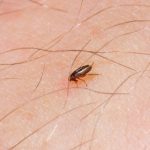 Pulga em Corpo Humano