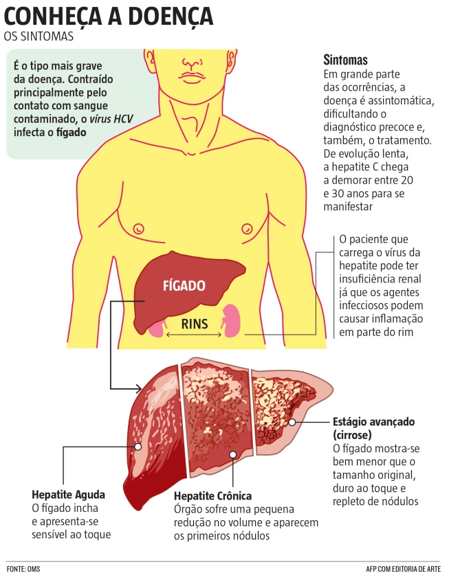 Hepatite