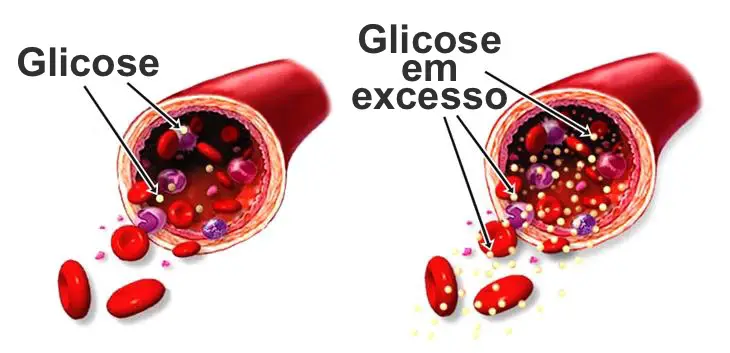 Glicose No Sangue 
