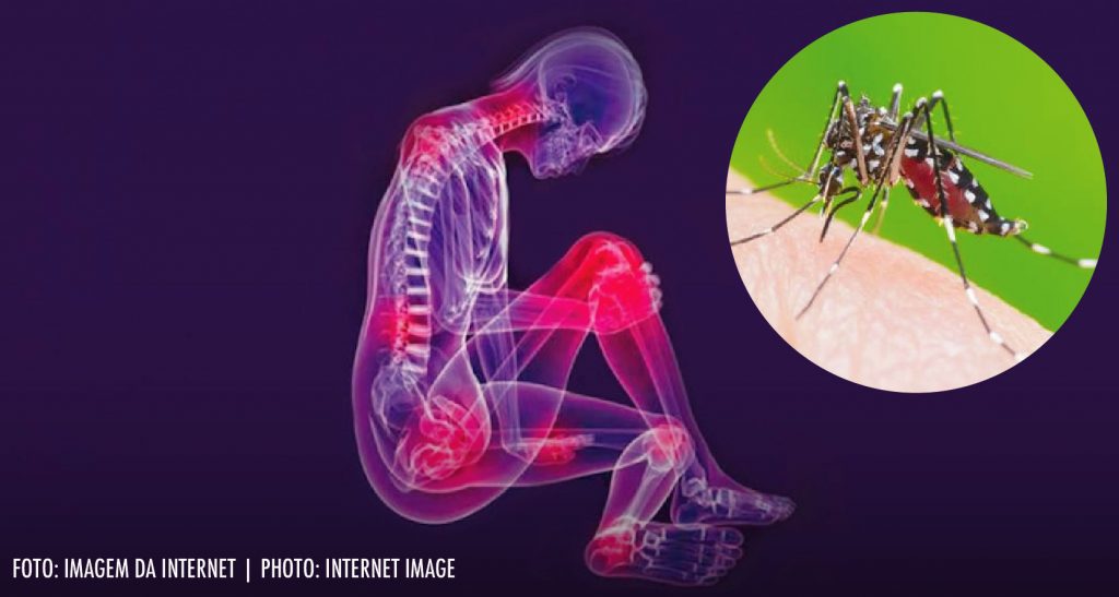 Chikungunya