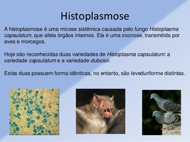 Histoplasmose