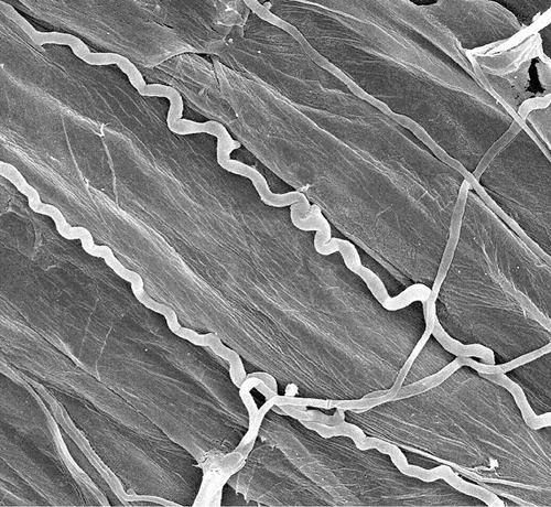 Neotyphodium Coenophialum