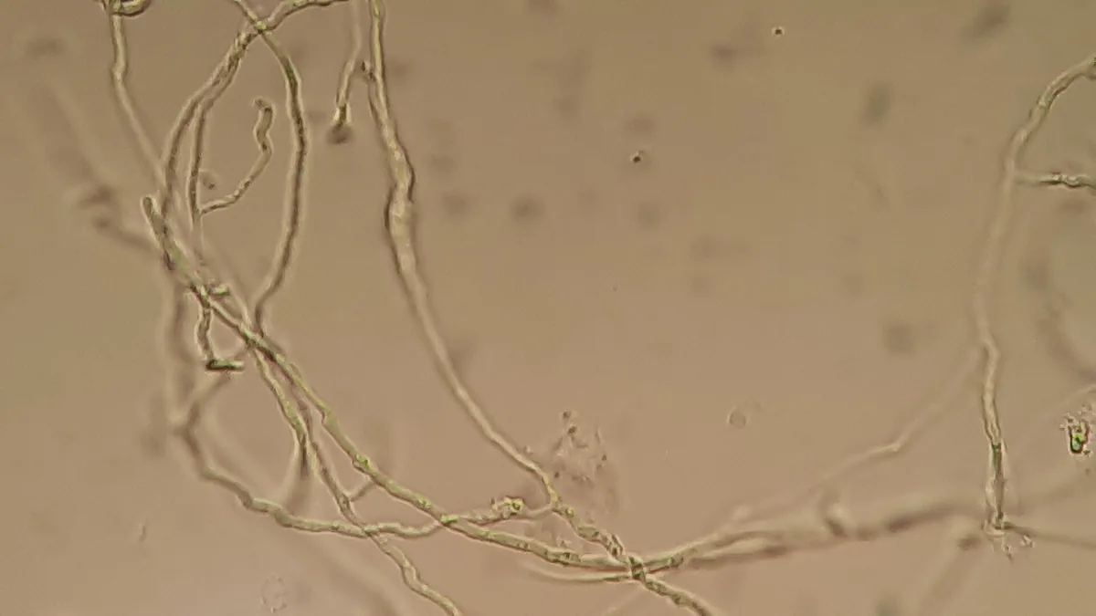 hifas hialinas septadas e ramificadas de fungo vistas ao microscópio